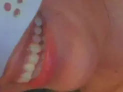 Amateur Nude Webcam of Mohnblume