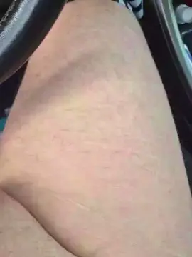 Cam4 Live Porn of imfreienzeigen