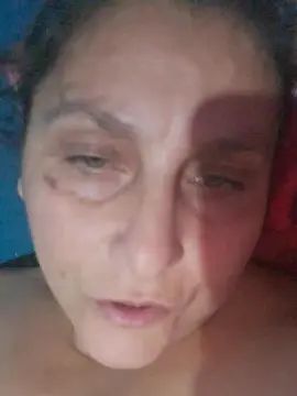 Cam4 Nude Webcam of 27287735044