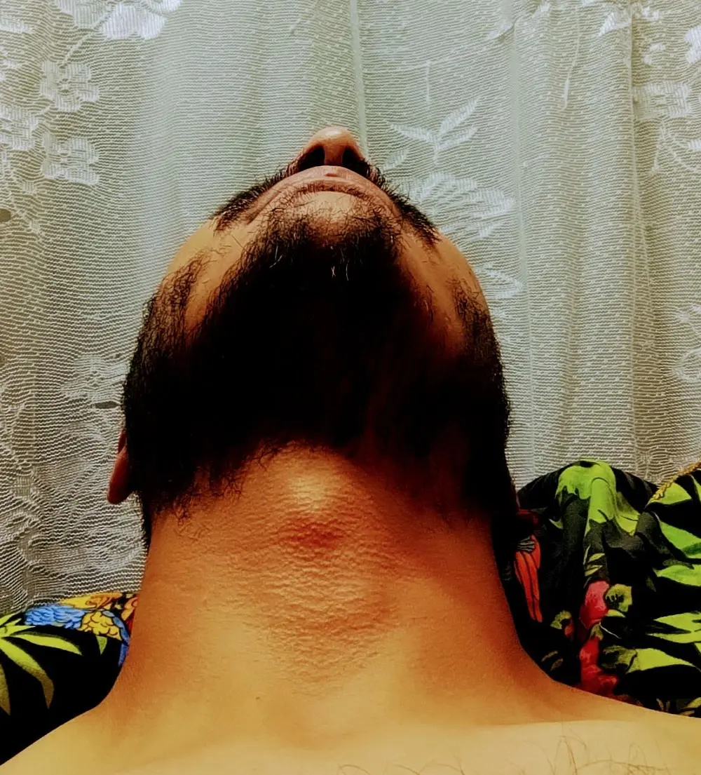 mbatraod