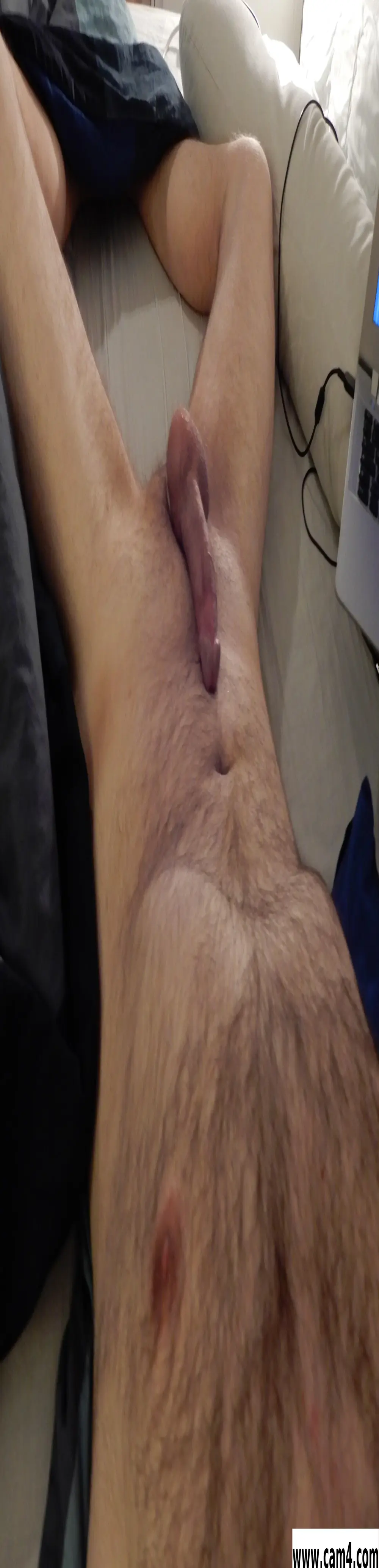 calcaneus85