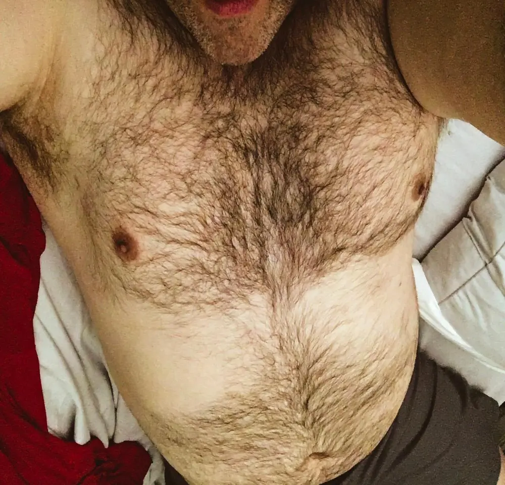 DAG_NABBIT
