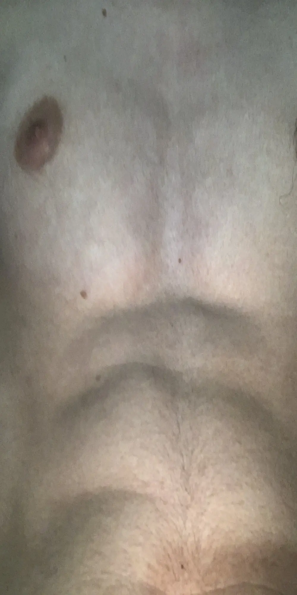 mm34974