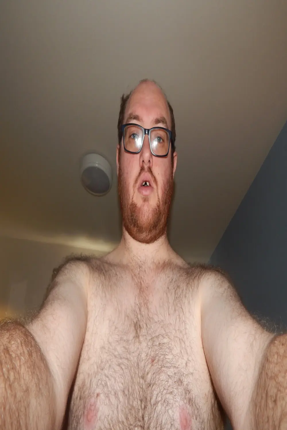petecolossus